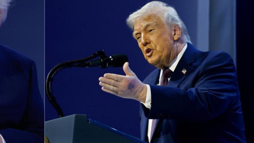 motivul pentru care donald trump a aparut cu mana invinetita la davos adevarul despre medicamentele pe care le ia zilnic nu risc nimic 69733d735f983
